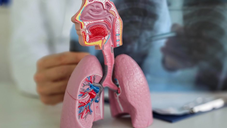 Pneumoperitoneul